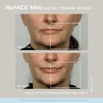 NuFACE MINI Starter Kit,White - Image 5