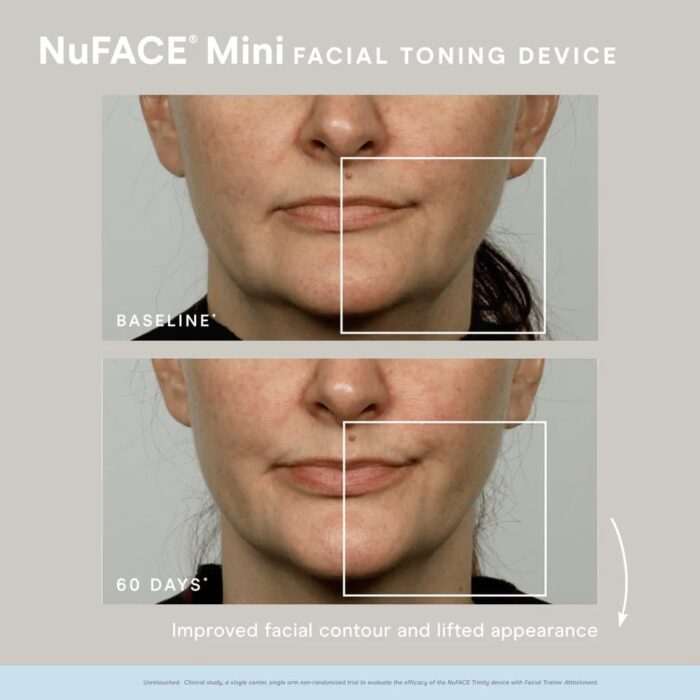 NuFACE MINI Starter Kit,White - Image 5