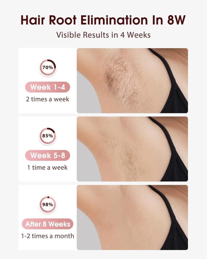 LYSMOSKI Laser Hair Removal, IPL Hair Removal with Ice-Cooling System for Painless & Long-Lasting Result, Safe At-Home Hair Remover Device for Armpits Back Legs Arms Face Bikini Line - Image 2