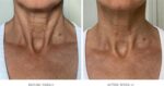 City Beauty Ultra-Firming Dry Oil - Neck & Décolletage Treatment - Hydrate & Lift - Solution for Crepey Skin, Sagging, & Wrinkles - Non-Greasy Formula - Anti-Aging Cruelty-Free Skin Care - Image 2