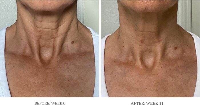 City Beauty Ultra-Firming Dry Oil - Neck & Décolletage Treatment - Hydrate & Lift - Solution for Crepey Skin, Sagging, & Wrinkles - Non-Greasy Formula - Anti-Aging Cruelty-Free Skin Care - Image 2