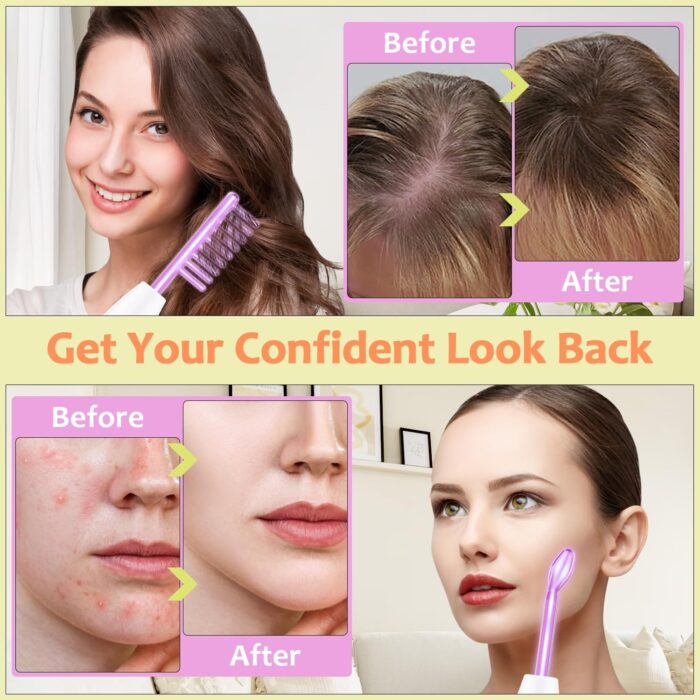 Uaike High Frequency Facial Wand - 4 in 1 Violet Portable Handheld High Frequency Facial Machine - at Home Face Skin Wand Device with 4 Pcs Purple Glass Tubes - Image 5