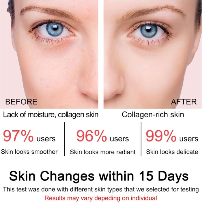 SOYUB Collagen Jelly Cream - Contains Niacinamide & Freeze Dried Hydrolyzed Collagen -Elasticity & Hydration, Reduce Fine Lines & Dullness, Korean Skin Care For All Skin Types (3.38 fl.oz) - Image 3