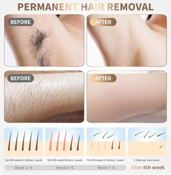 Home Use Beauty Device IPL Laser Hair Removal for Women and Men,999999 Flashes at-Home Laser Hair Removal Device - Image 5