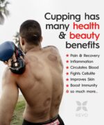 Revomadic REVO The Original 4-in-1 Smart Cupping Therapy Massager, Red Light Therapy for Targeted Pain Relief, Knots, Aches, Muscle Soreness, Circulation & Tighter Skin, Portable Cupping Kit - Image 3
