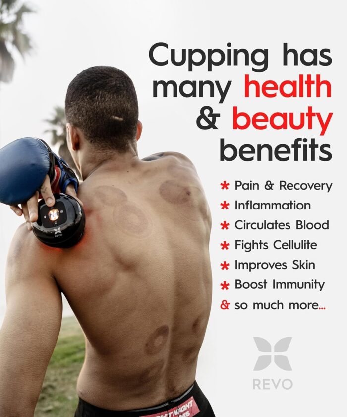 Revomadic REVO The Original 4-in-1 Smart Cupping Therapy Massager, Red Light Therapy for Targeted Pain Relief, Knots, Aches, Muscle Soreness, Circulation & Tighter Skin, Portable Cupping Kit - Image 3