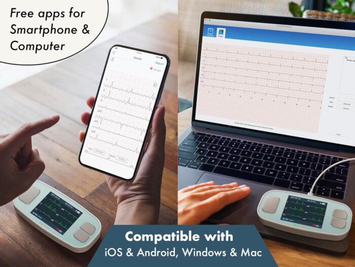 EMAY 6L Portable ECG Monitor | Record ECG and Heart Rate in 6 Channels | Compatible with Smartphone and PC | No Subscription Required - Image 8