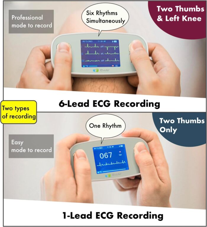 EMAY 6L Portable ECG Monitor | Record ECG and Heart Rate in 6 Channels | Compatible with Smartphone and PC | No Subscription Required - Image 5
