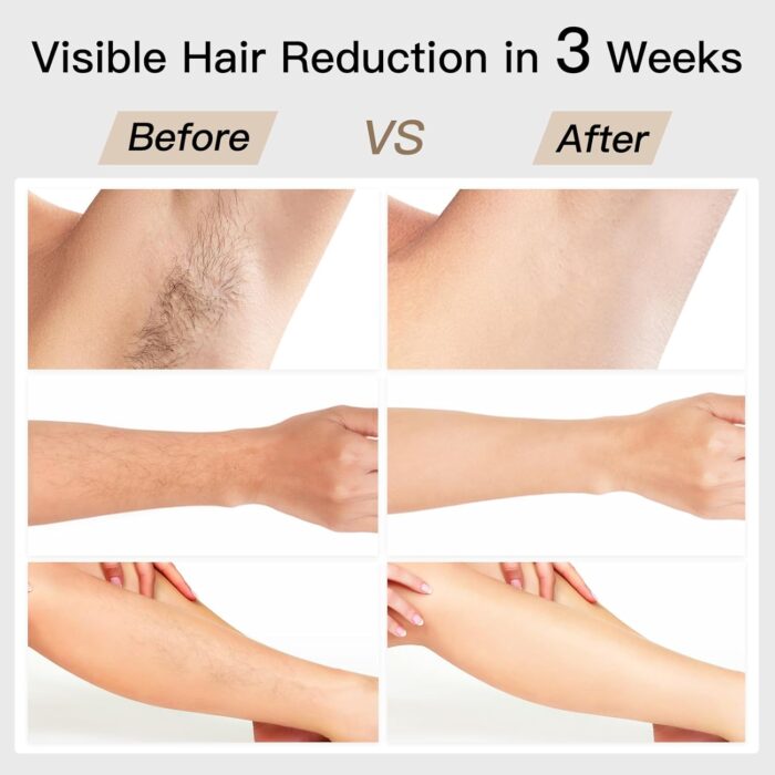 BoSidin Laser Hair Removal, IPL Hair Removal with Painless Ice-Cooling, 2-in-1 Face SR Rejuvenation, 6+1 Modes, 6 Levels Hair Removal for Women Permanent, Laser Hair Removal Kit with Shaver, Goggles - Image 3