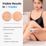 Oreeth IPL Laser Hair Removal Device for Women & Men - Home 45°F Ice-Cooling Contact for Painless & Long-Lasting Results, 86% Hair Reduction in 3 Weeks for Full Body & Bikini Line, White - Image 2
