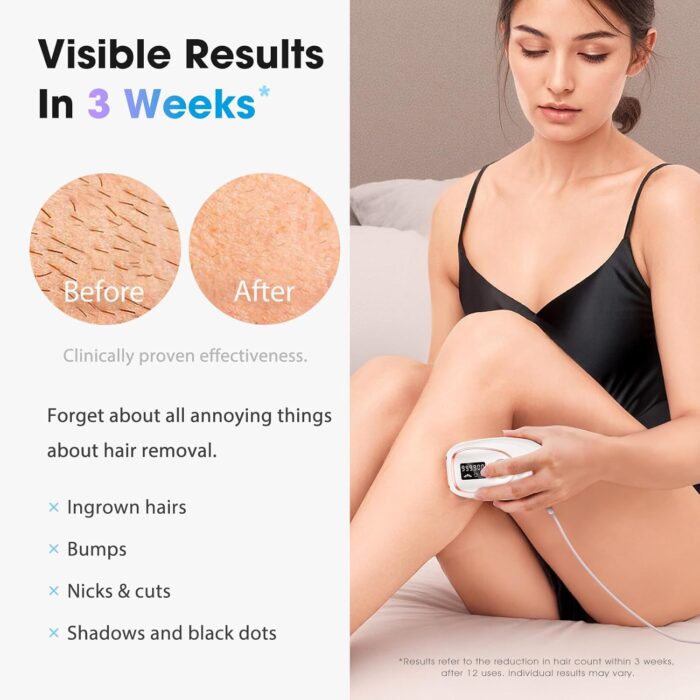 Oreeth IPL Laser Hair Removal Device for Women & Men - Home 45°F Ice-Cooling Contact for Painless & Long-Lasting Results, 86% Hair Reduction in 3 Weeks for Full Body & Bikini Line, White - Image 2
