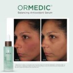 IMAGE Skincare, ORMEDIC Balancing Antioxidant Serum, Hydrates & Soothes Skin with Organic Aloe Vera, Vitamin C, & Botanical Extracts, 30 mL - Image 3