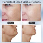 Beauenty Anti Wrinkles Neck Face Massager, Skin Care Face Massage, 3-in-1 Skin Care Tools - Heating, 3 Modes & 9 Vibration Frequencies for Anti-Aging, Smooth and Tightening (Style A) - Image 5