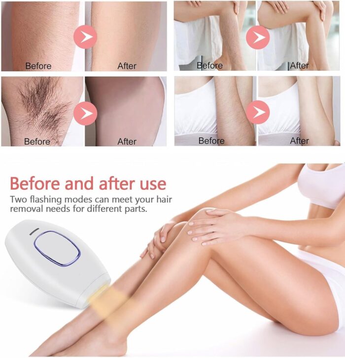 Home Use Beauty Device IPL Laser Hair Removal for Women and Men,999999 Flashes at-Home Laser Hair Removal Device - Image 3