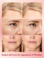 Radio Frequency Skin Tightening Device, Professional Wireless Home RF Skin Tightening Face Machine, Effective Face Wrinkle Removal, Lifting, Firming - Image 2