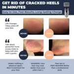 Electric Callus Remover for Feet: Best Pedicure Tools for Men by Own Harmony with 3 Rollers (Powerful), Electronic Pedi Spa Foot File Care - Perfect for Hard, Cracked, Dry, Dead Skin (USB Cable) - Image 2