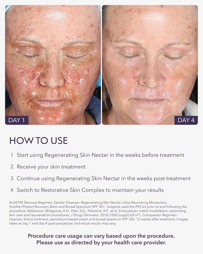 ALASTIN Skincare Regenerating Skin Nectar Face Moisturizer (1 oz) | Hydrating Serum Strengthens & Soothes Post-Procedure Skin | Safe for Sensitive Skin - Image 5