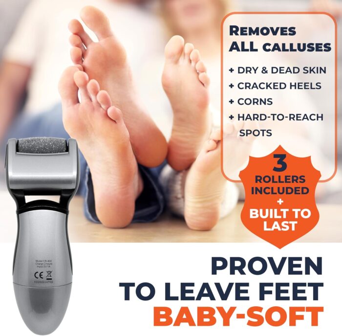 Electric Callus Remover for Feet: Best Pedicure Tools for Men by Own Harmony with 3 Rollers (Powerful), Electronic Pedi Spa Foot File Care - Perfect for Hard, Cracked, Dry, Dead Skin (USB Cable) - Image 3