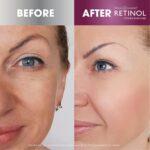 Retinol Skincare LdeL Cosmetics Day Cream with SPF 20 2.25 oz - Image 5