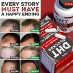 Hairo Nutrition DHT Blocker Growth Supplement - High Potency Biotin & Saw Palmetto for Regrowth - Natural Loss Treatments for Women & Men - Helps Stimulate Follicle Growth - Image 5