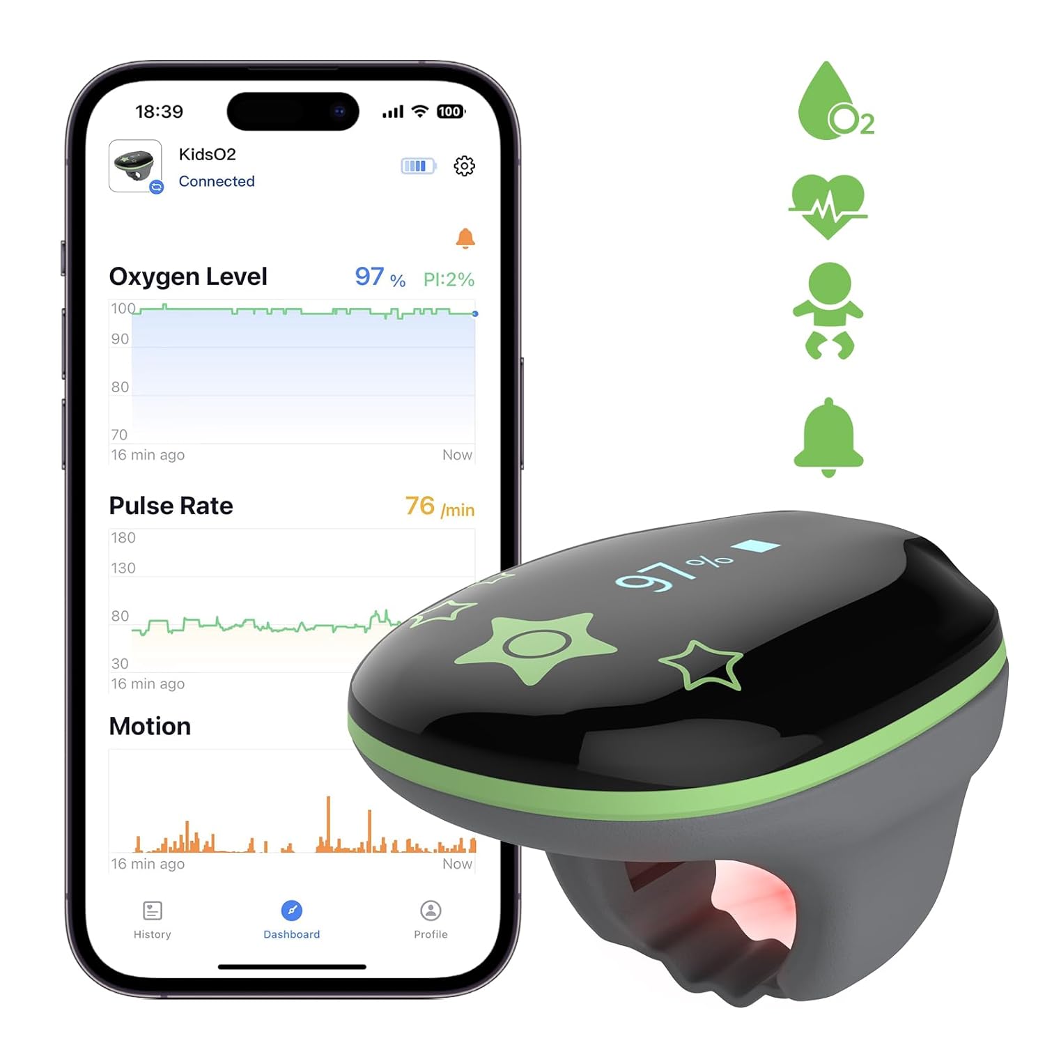 KidsO2 Ring Pulse Oximeter for Children – Continuous Blood Oxygen Saturation & Pulse Rate Monitor with Audible Reminder, – Rechargeable Finger Pulse Ox O2 Ring for Ages 3-10, Includes App & PC Chart Reporting